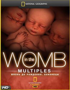 Жизнь до рождения. Блезницы / In The Womb. Twins, Triplets And Quads (2007) HDTV [720p]